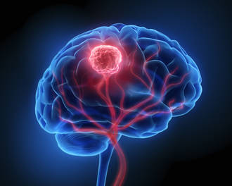 traitement_cancer_cerveau