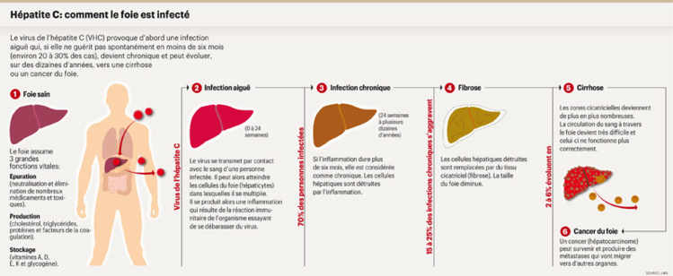 Hépatite C: comment le foie est infecté