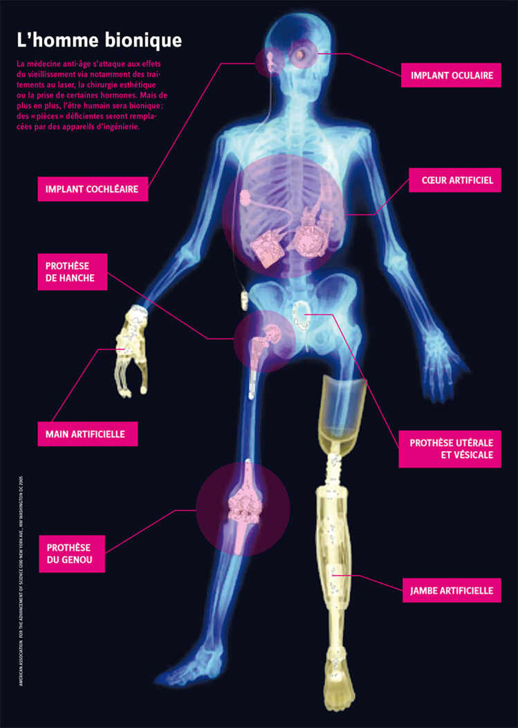L'homme bionique