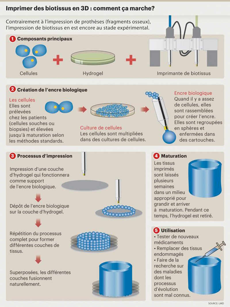 L’impression 3D est en passe de révolutionner la chirurgie