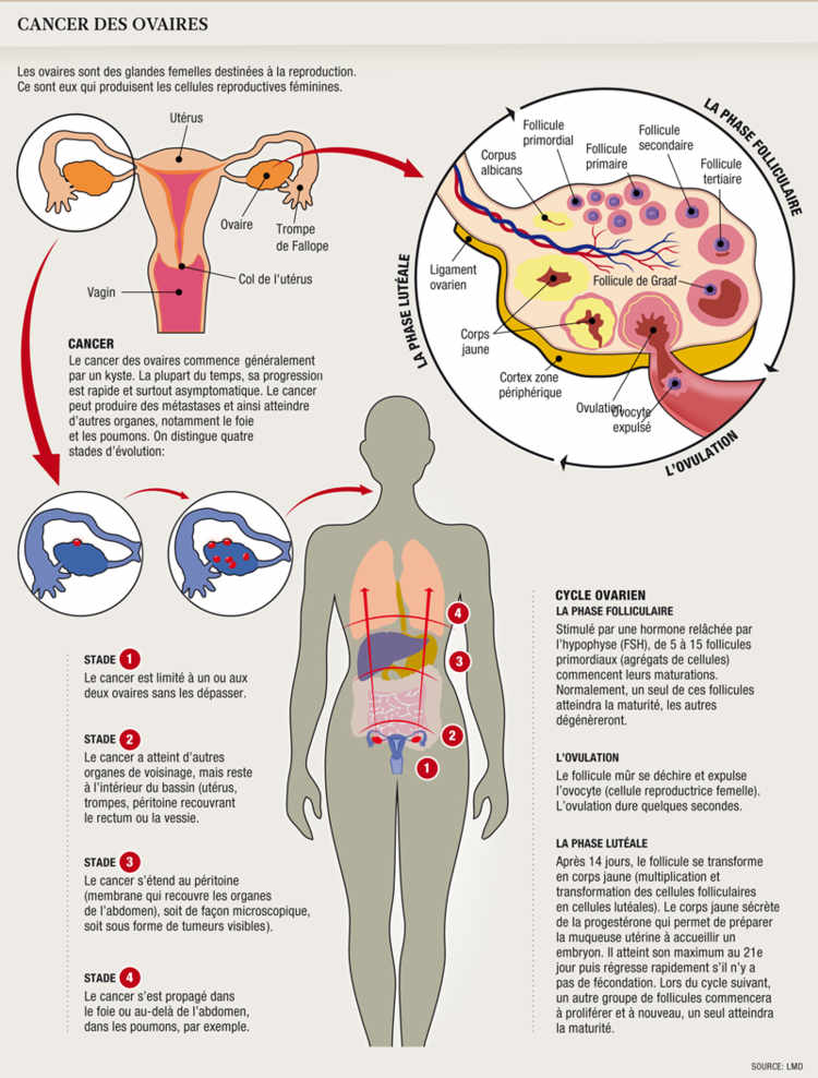 cancer ovaire et papillomavirus)