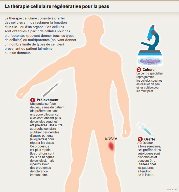 cellules_miracles_infog