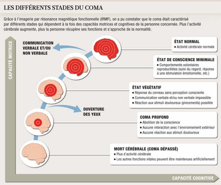 Les différents stades du coma