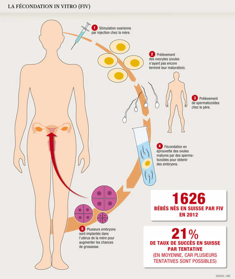 La fécondation in vitro (FIV)