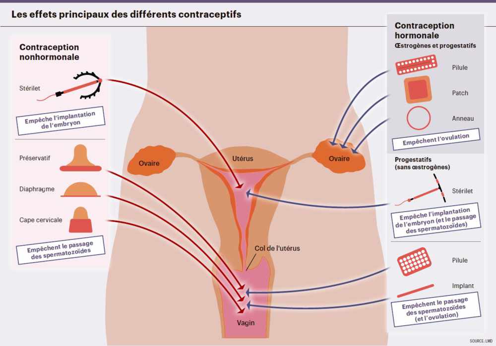 infog_Choix contraception