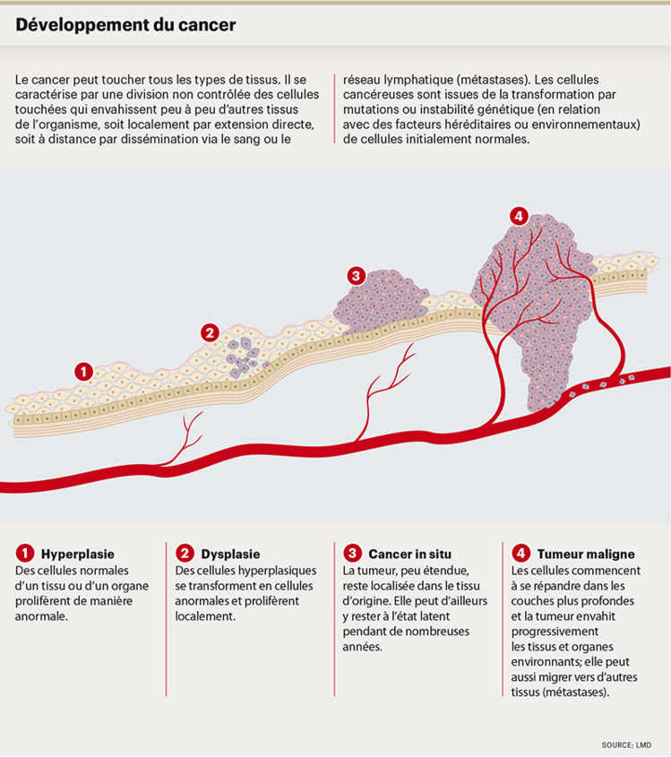 Développement du cancer