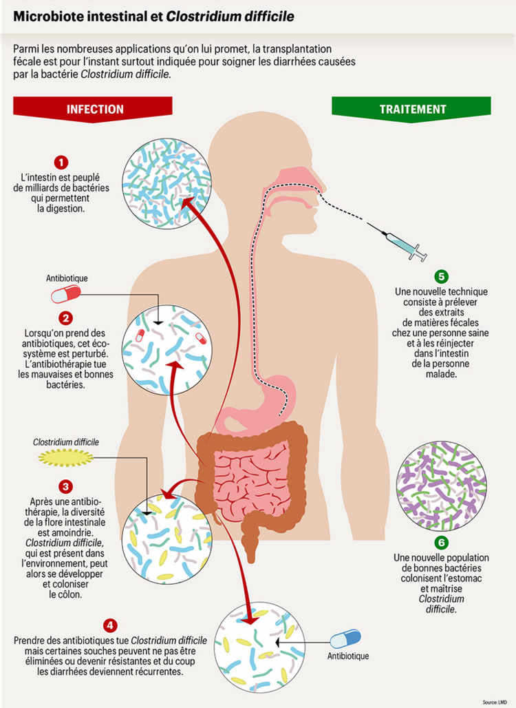Microbiote intestinal et Clostridium difficile