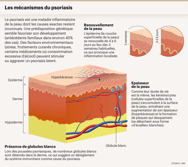 Les mécanismes du psoriasis