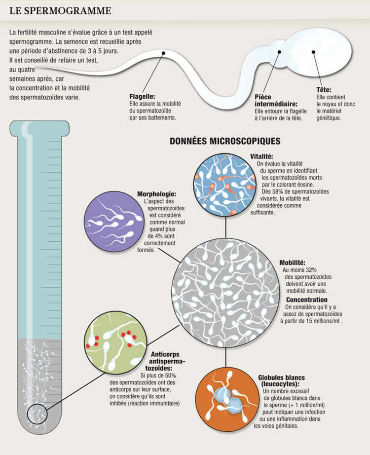 Le spermogramme