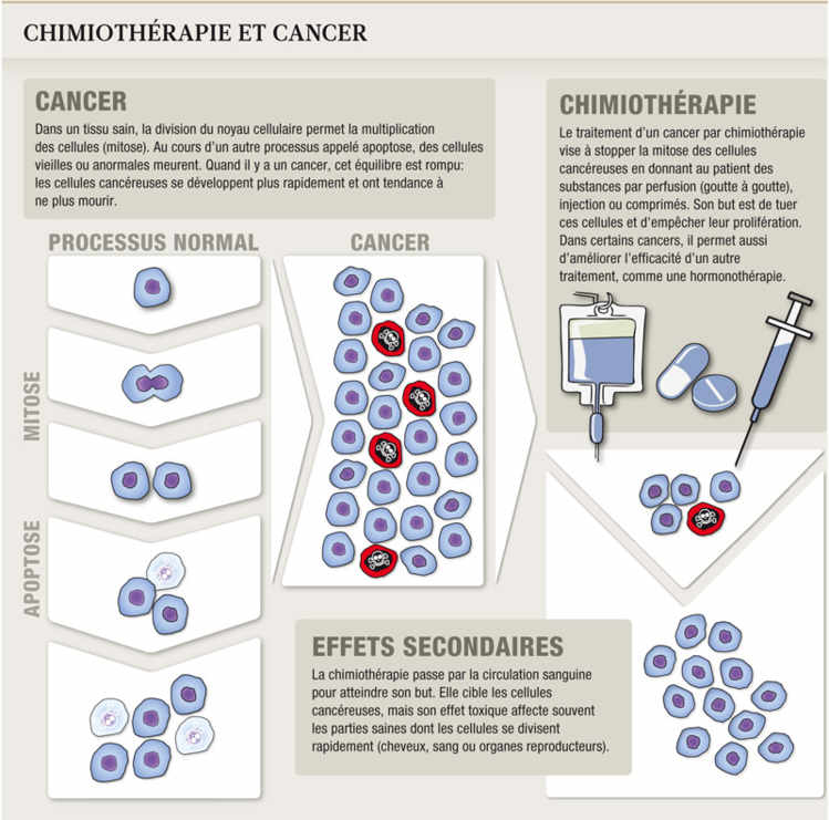 Chimiothérapie et cancer