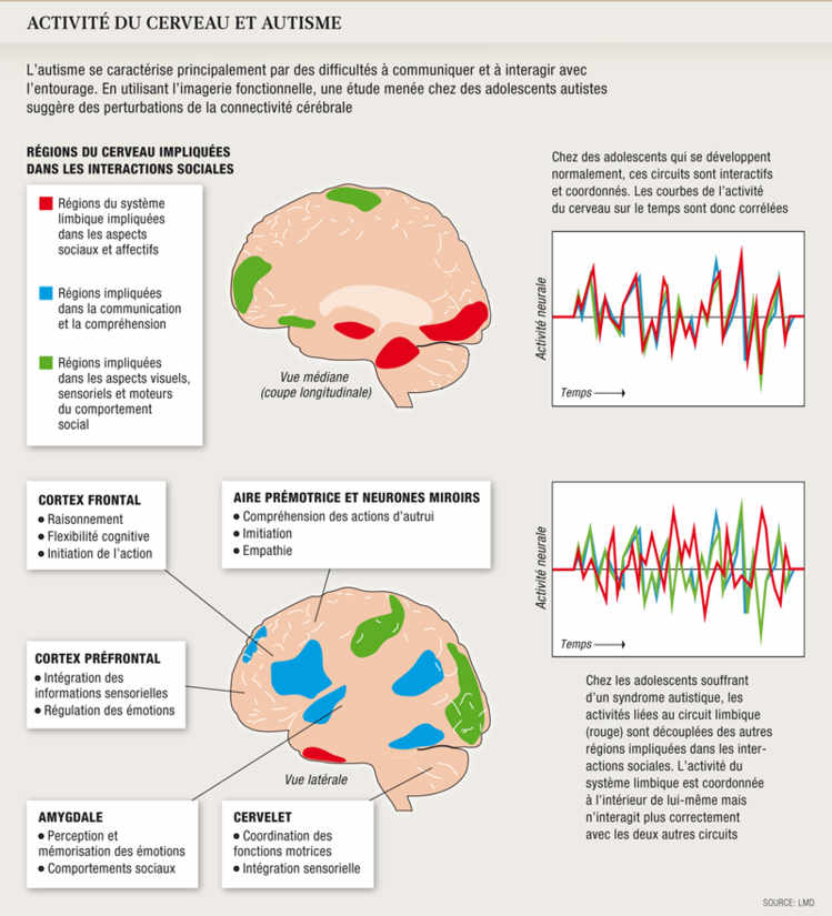 Activité du cerveau et autisme