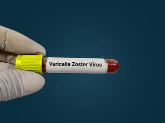 36.9_ vaccin_varicelle_zona _36.9