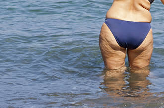 36.9_dyspraxie_maladroit