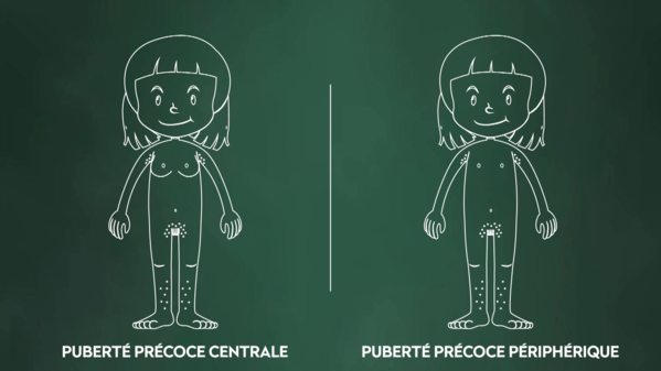 36.9_pubertes_precoces