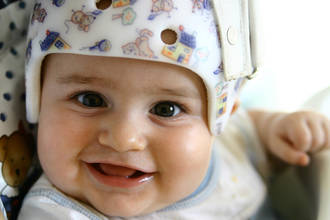 36.9_tete_plate_nourrisson