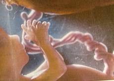 36.9_congeler_cellules_souches