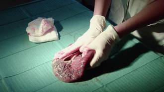 36.9_dechets_anatomiques