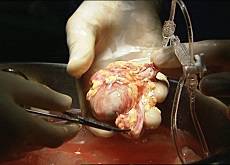 36.9_don_organes_suisse