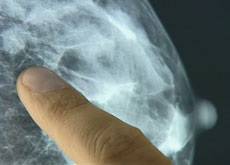 36.9_hormones_cancer_sein