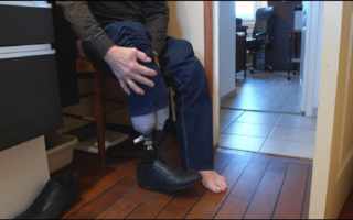 36.9_infections_nosocomiales