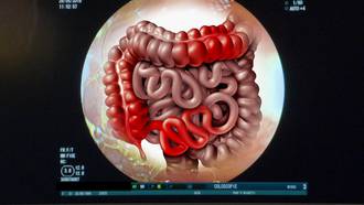 36.9_maladies_inflammatoires_intestin