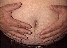 36.9_obesite_comment_sortir