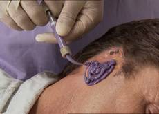 36.9_oreille_cassee 36.9_alzheimer_enigmes