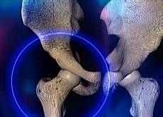 36.9_osteoporose_vieux_os