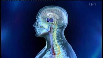 36.9_Stress_post_traumatique