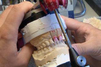 36.9_Tarifs_dentaires