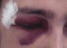 36.9_victimes_agressions_experts