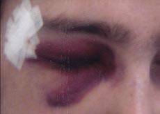 36.9_victimes_agressions_experts