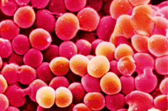Staphylococcus aureus –Médaille d’or des infections