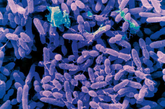 6/ Streptomyces griseus – La fabrique à antibiotique