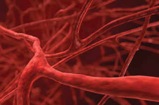 Quoi de neuf dans le traitement de la thrombose veineuse profonde?
