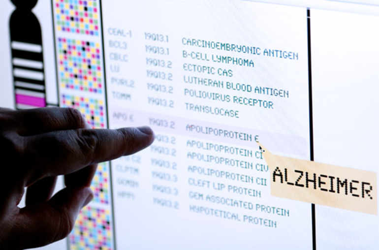 Maladie d’Alzheimer: nouvelles théories sur les origines biologiques et les facteurs de risque