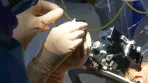 Parkinson: une opération qui change la vie 