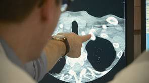 Attaque cérébrale: un AVC à 40 ans