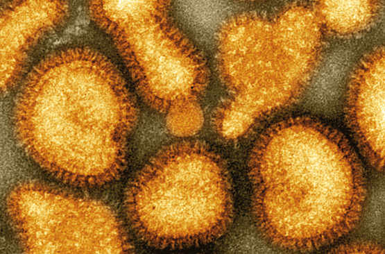 Virus de la grippe 