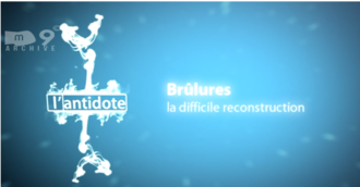 Brûlures: la difficile reconstruction