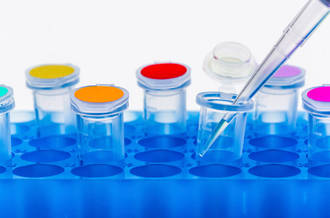 L’urine: une source d’informations pour les médecins